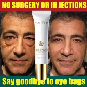 SADOER Anti-Aging Rapid Reduction Eye Cream