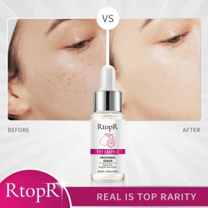RtopR Viamin C Whitening Moisturizing Serum